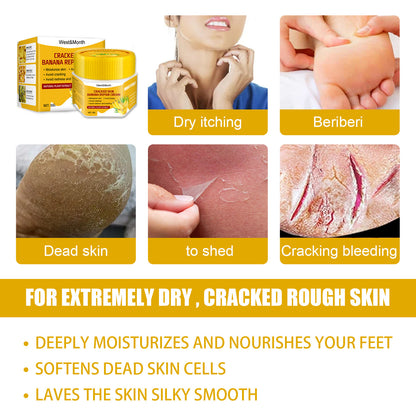 Moisturizing Banana Foot Repair Cream for Chapped Feet