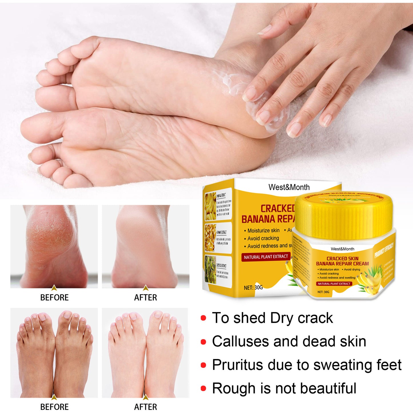 Moisturizing Banana Foot Repair Cream for Chapped Feet