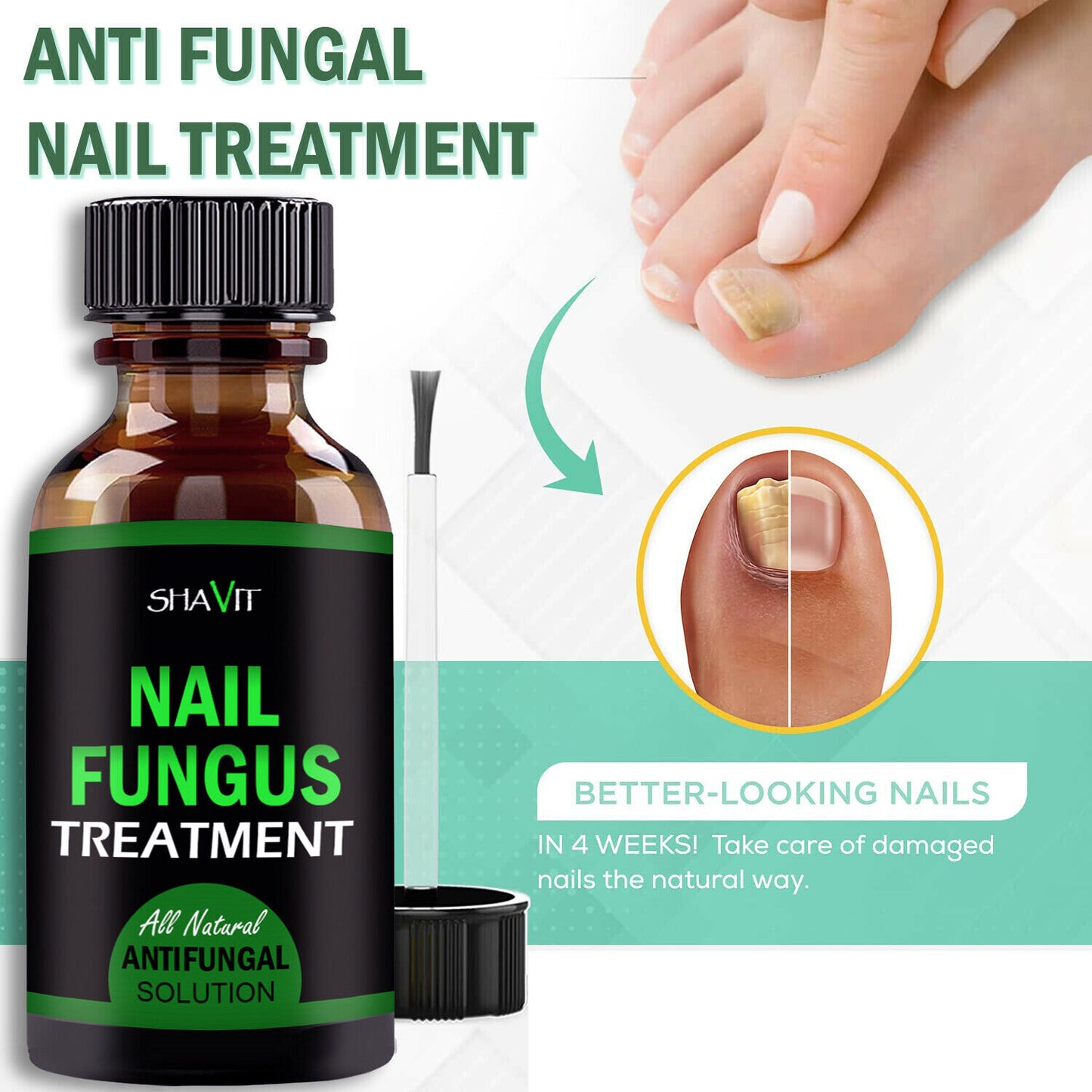 Anti-Fungal Treatment - Extra Strength